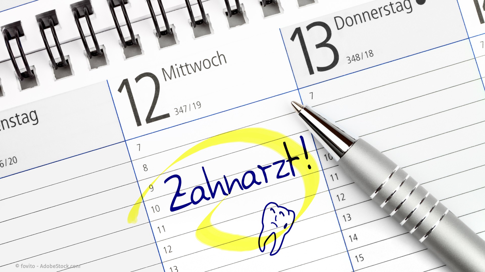 Regelmäßige Kontrollen und Professionelle Zahnreinigungen nach einer Parodontitis-Behandlung