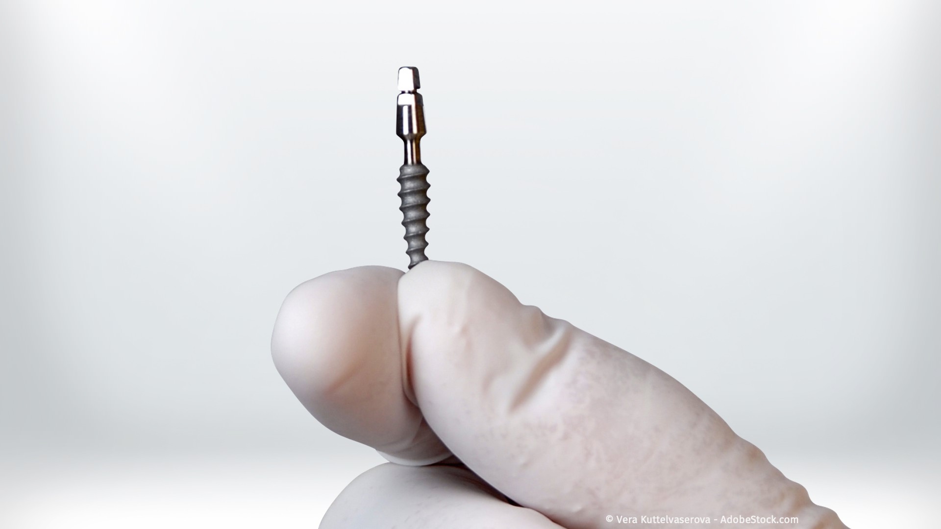 Minimalinvasive Implantation